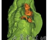 3D技术利用罕见化石“复活”地球最早动物